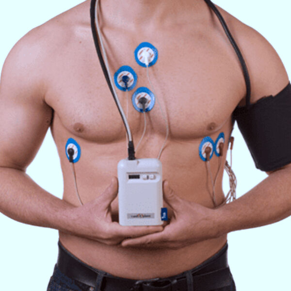 HOLTER CARDIACO
